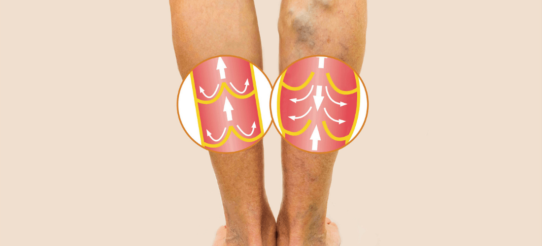 Vein and Laser Center Doylestown Health